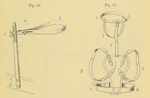 Hennig's Geradehalter
